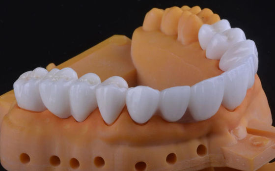 Buy High Strength Zirconia Tooth Crown Ultra Translucent With Long Term Stable online manufacture