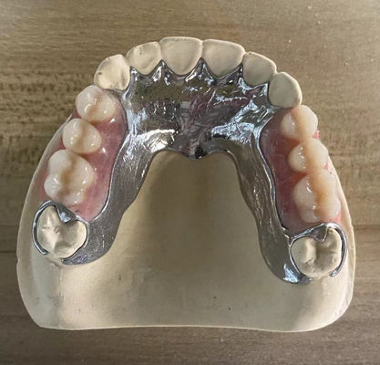 Buy High Strength Casting Metal Partial Denture Cocr Aolly With 3D Printing online manufacture