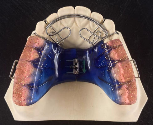 Buy High Accuracy Orthodontic Removable Appliance Safety Clear Hawley Retainer online manufacture