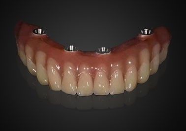 Buy Customized Replacing Dental Implant Crown Wear Resistant For Long Term Use online manufacture