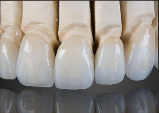 Buy Wieland Zirconia All Ceramic Crown Inner Painting Customized With CAD Design online manufacture