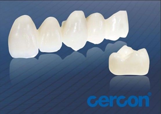 Buy Wear Resistance CAM Cercon Zirconia Crowns Easy Cleaning High Biocompatibility online manufacture