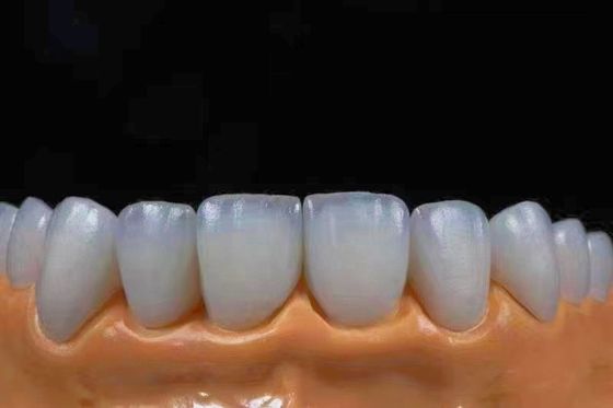 Buy Highly Translucent Esthetic Zirconia Crowns Precise Fit with Natural Looking online manufacture