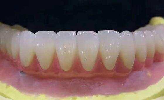 Buy Customized Dental Zirconia Tooth Crown Stain Resistant With High Precision online manufacture