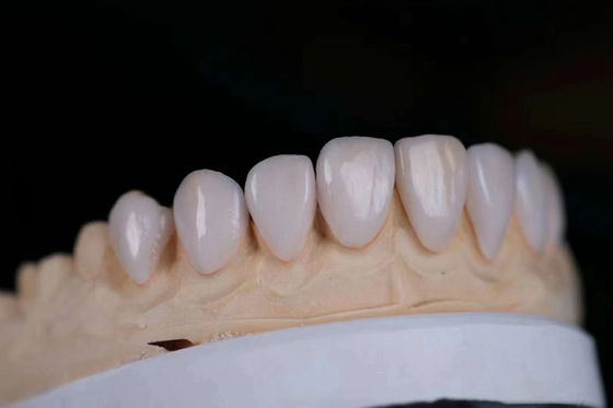 Buy Long Lasting Multi Layered Ceramic Zirconia Crown Adjustable with FDA Certified online manufacture