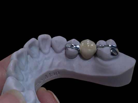 Buy Accurate White Long Lasting Maryland Bridge Dental Customizable For Restoration online manufacture