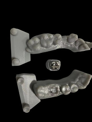 Buy Corrosion Resistant Metal Post And Core High Adhesion For Dental Restoration online manufacture