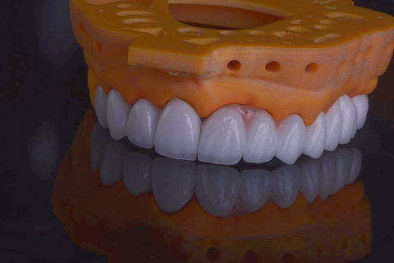 Buy High Strength Dental Lab Crowns Natural Looking For Tooth Restoration online manufacture
