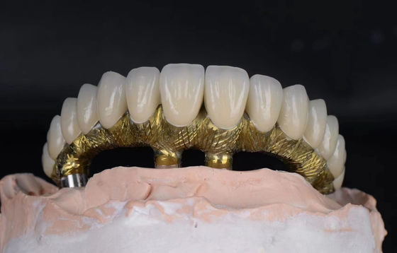 Buy Titanium Alloy Dental Implants And Crowns Natural Looking With Corrosion Resistant online manufacture