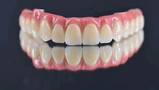 Buy Dental Lab Customized Implant Supported Metal Crown Natural Looking For Long Term Stability online manufacture