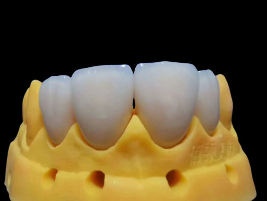 Buy Tear Resistant Fitting Full Zirconia Crown Customizable Safe To Use online manufacture