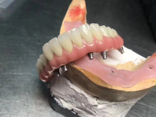 Buy High Translucency Solid  Implant Supported Crown Customizable For Dental Restoration online manufacture