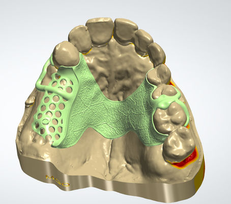Buy Digital Metal Framework CAD CAM Dental Design Cocr Material With 3D Printing online manufacture
