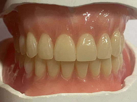 Buy Hypoallergenic Customized Removable Partial Denture With Pink Gum Color online manufacture