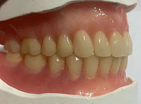 Buy Customized Natural Looking Full Denture Acrylic Teeth For Optimal Retention online manufacture