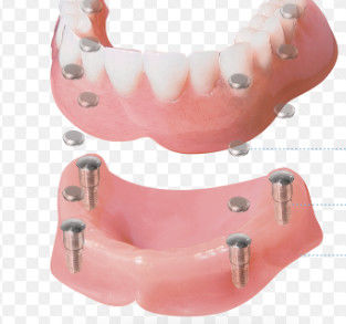 Buy High Precision Dental Magnetic Attachment Surface Polishing And Customizable online manufacture