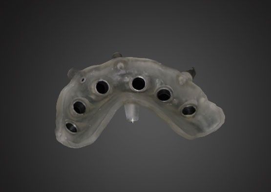 Surgical sguide Plan for Implant Supported Crown Design and Alveolar Bone Information