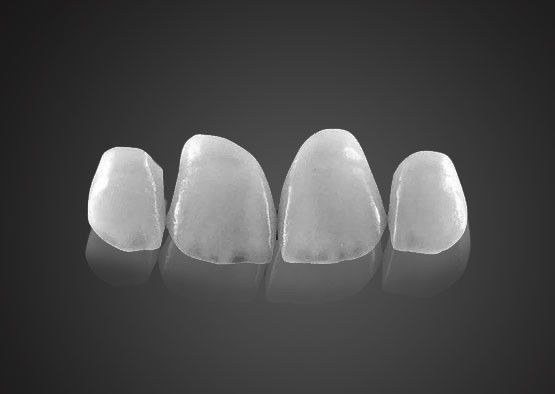 IPS 0.2mm Ultra Thin Emax Veneers Stain Resistant With High Strength