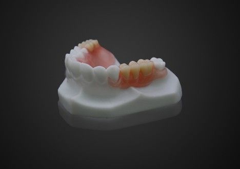 Lightweight Comfortable Valplast Partial Denture Easy Cleaning High Transparency