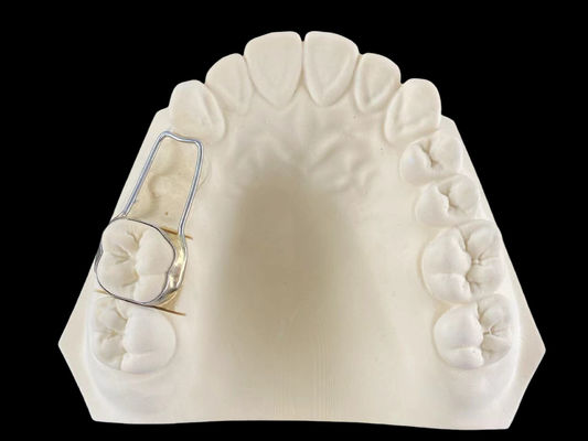 Flexible Band And Loop Space Maintainer Adjustable Orthodontic Functional Appliance