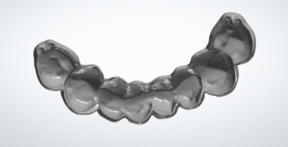 Milled Egg Shell CAD CAM Dental Design For PMMA Temporary Bridge Implant