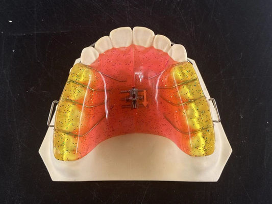 Customized 2 Ways Dental Arch Expander Adjustable Orthodontic Appliance