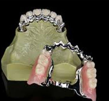 Long Term Use Customized Key And Keyway Dental With High Strength