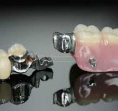 High Flexibility Mk1 Attachment Dental High Precision And Safety To Use